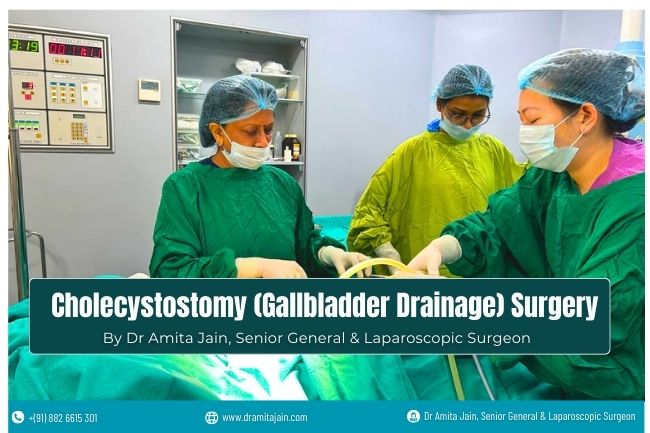Cholecystostomy Gallbladder Drainage Surgeon Dr Amita Jain